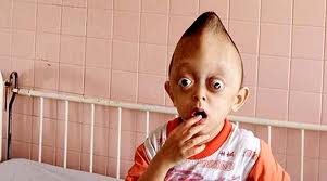 Only now the USA is going to remove some agent orange ‘defoliation’ dioxine ,causing a million deformed victims. Texte en français (+ official video by US Army on ‘defoliation’)